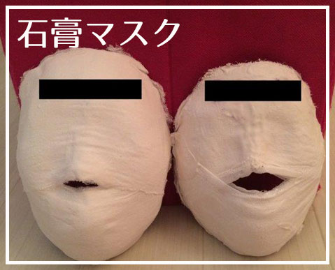 石膏マスク